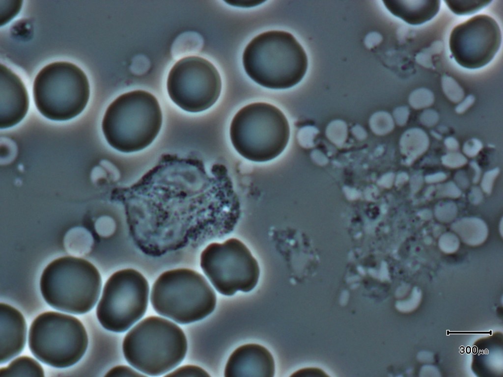 Live Blood Analysis Get Well with Lashell